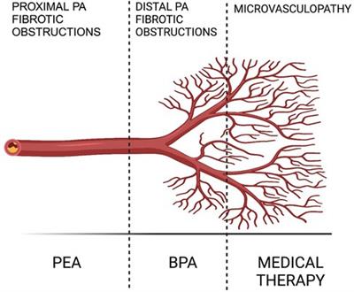 Chronic Thromboembolic Pulmonary Hypertension: the therapeutic assessment